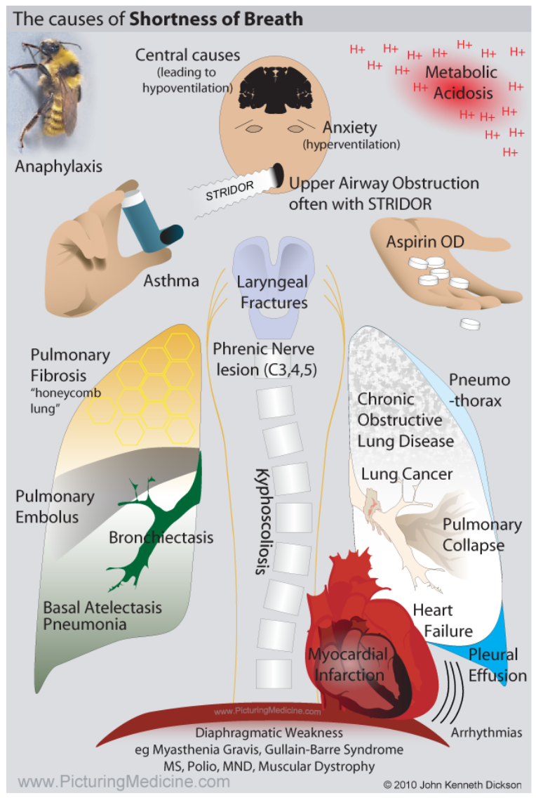 shortness of breath Causes