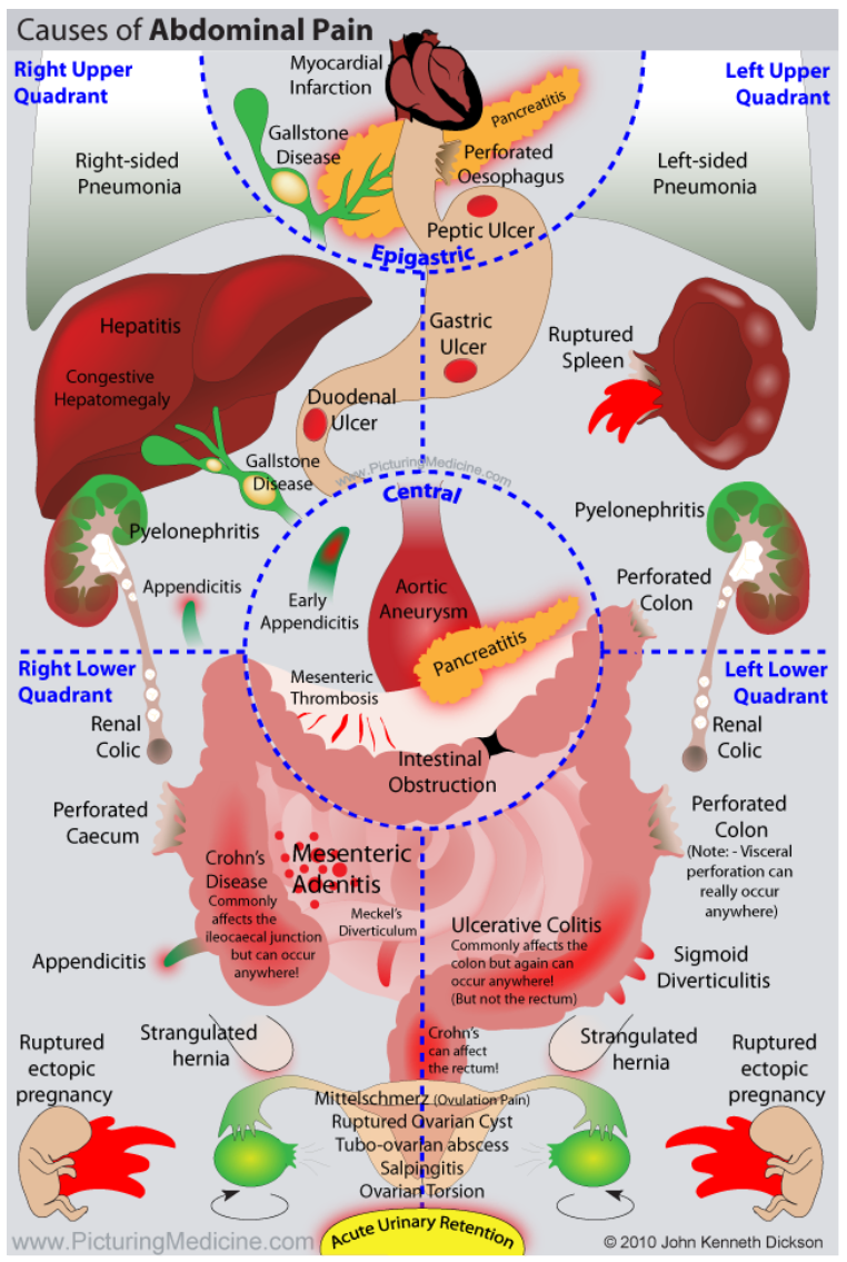 Abdominal Pain Symptoms & Causes