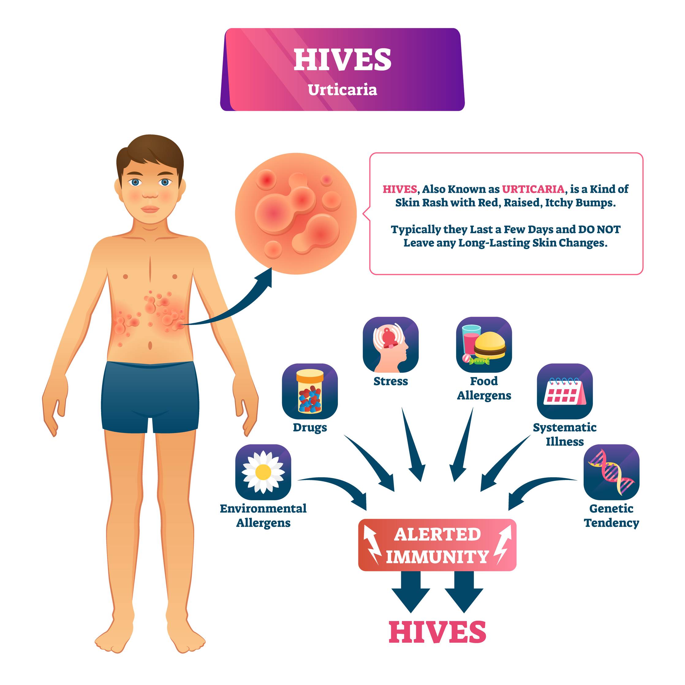 Hives From Pregnancy: Reasons, Signs & Treatment