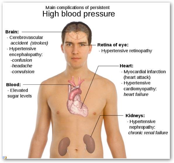 hypertension causes and effects